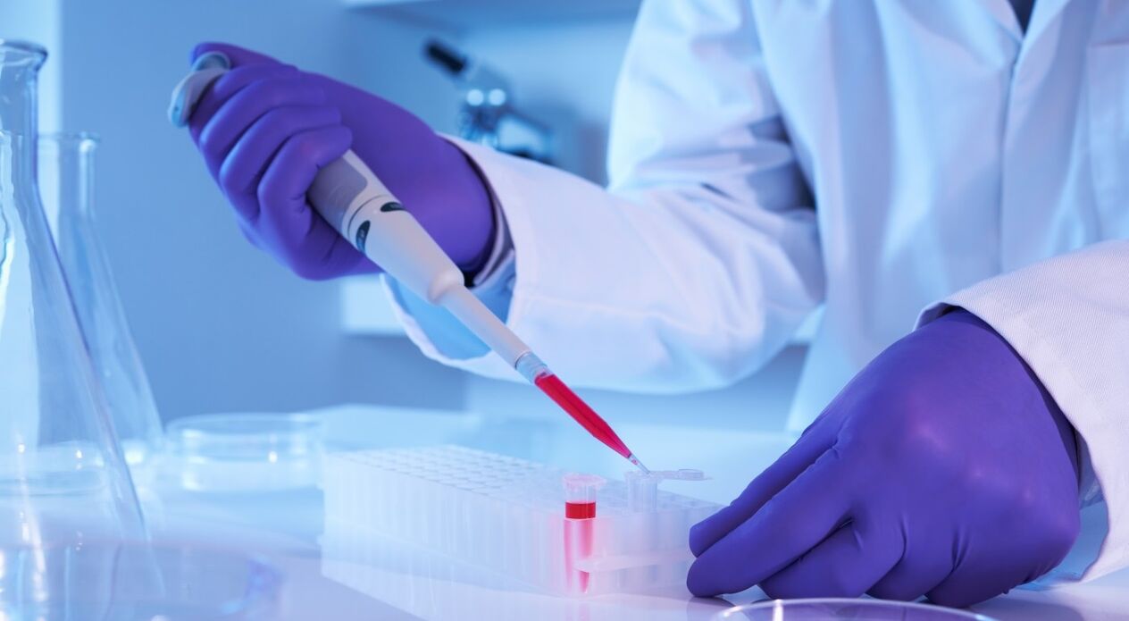Comment faire une analyse du parasite