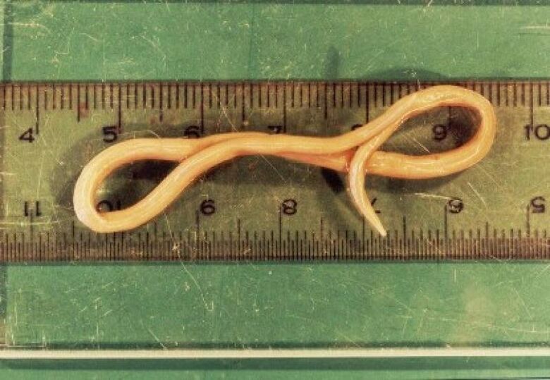 parasite nématode du corps humain